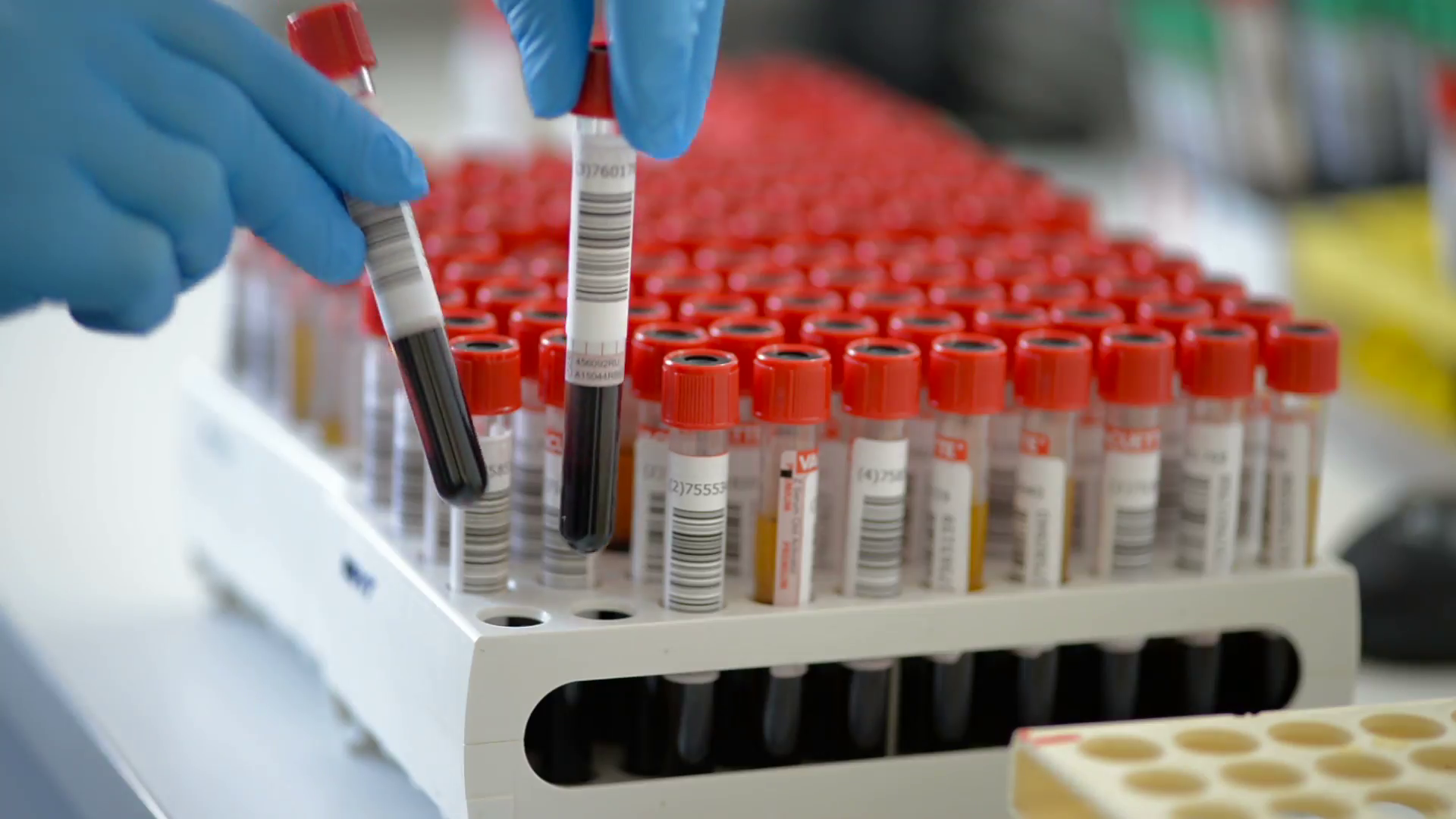 blood test home collection Haemovigilance International to  How Network participate